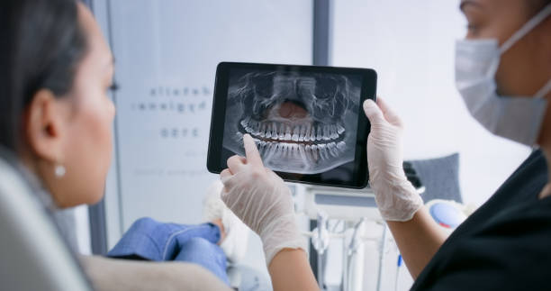 Licensed Tooth Extraction service in San Mateo County County, CA - Smile Center Dentistry